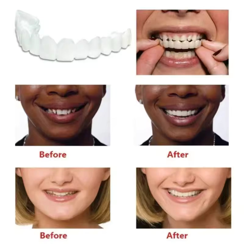 Teeth Whitening Teeth Snap on Silicone Smile Veneers Teeth Dental
